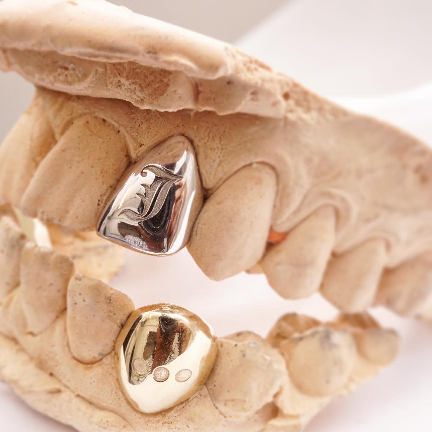 Single (custom) engraved tooth