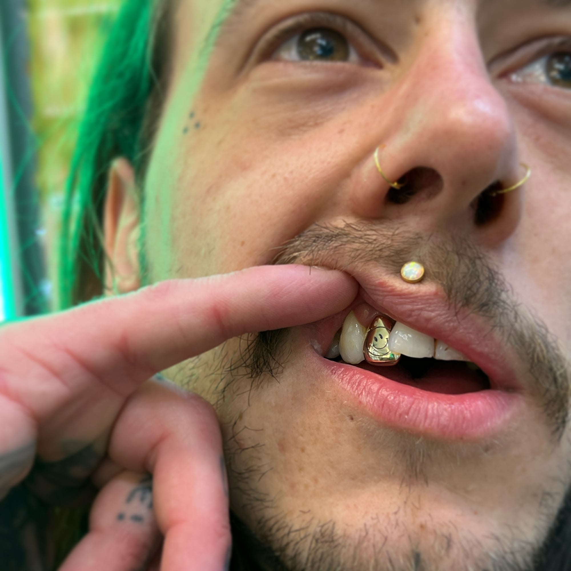 Single (custom) engraved tooth